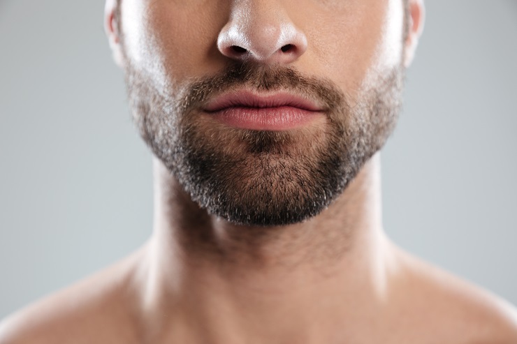 Injerto de barba